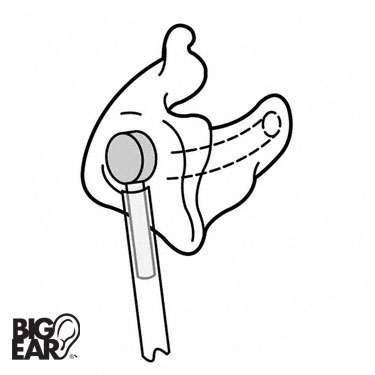 RAS diagram